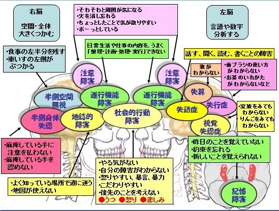 障害 症状 機能 高 次 脳